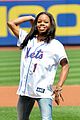 douglas-mets
