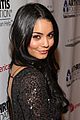 hudgens-arthritisf