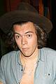 harry-unbuttoned