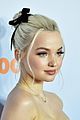 dove-kcas