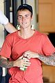 bieber-sunburn