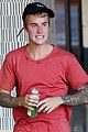 bieber-sunburn
