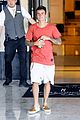 bieber-sunburn