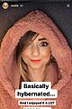 zoella-ig
