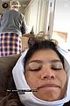 zendaya-teeth