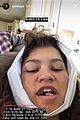 zendaya-teeth