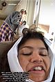 zendaya-teeth