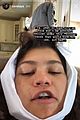 zendaya-teeth