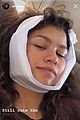 zendaya-teeth