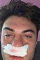 dolan-sinus