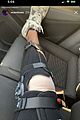 noah-knee