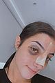 charli-nose