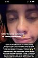 billie-image